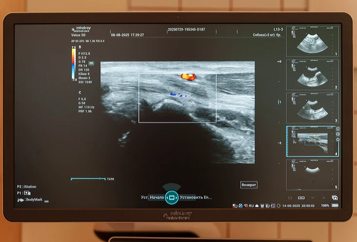 УЗИ - фото3