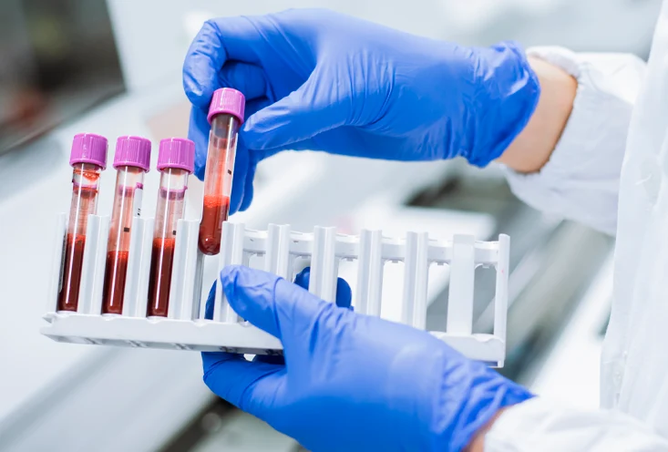 Общий анализ крови - фото1