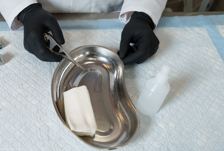 Зашить рану - фото3